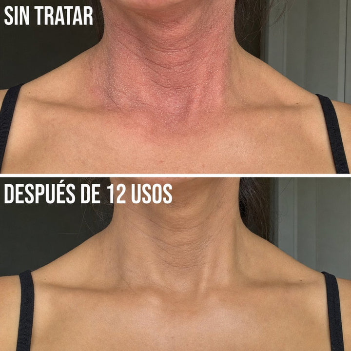 Complejo Reparador de Barrera — Adiós Eczema