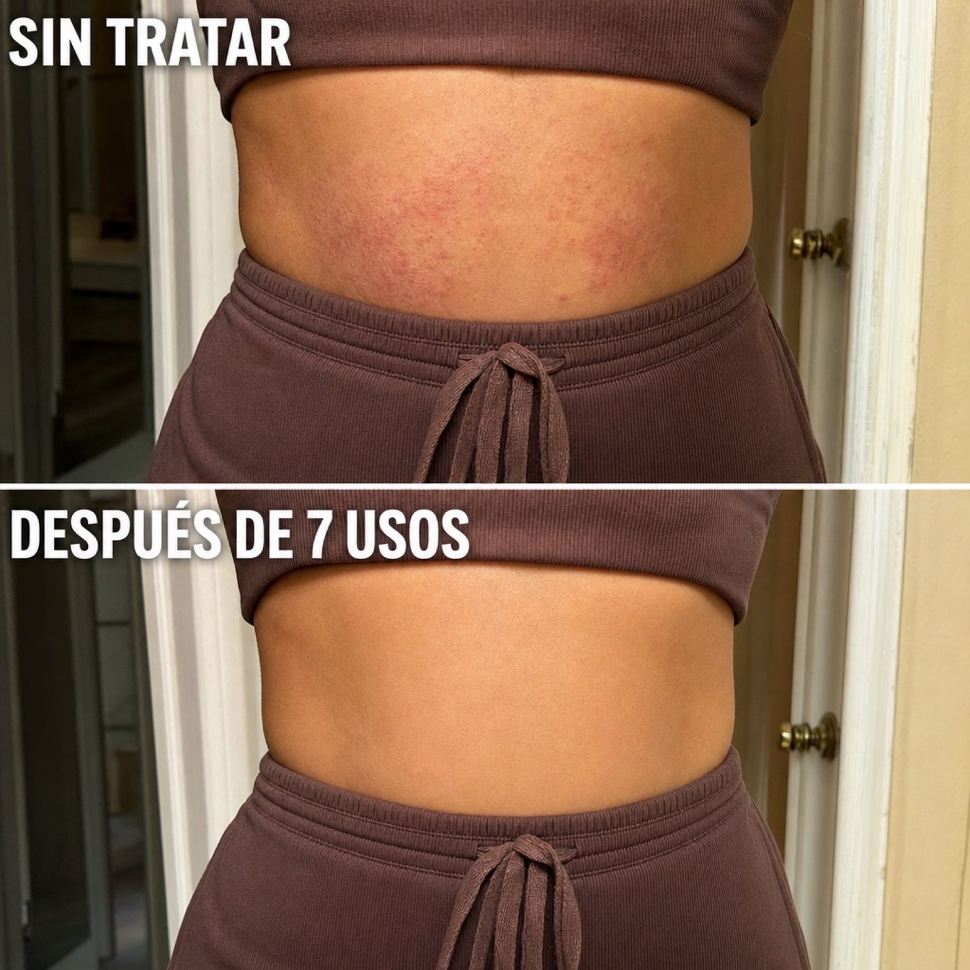 Abdomen sin tratar vs. después de 7 usos