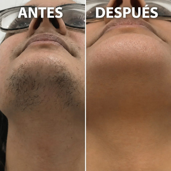 Sérum Adiós Vello — Esencia Reductora Post-Depilación