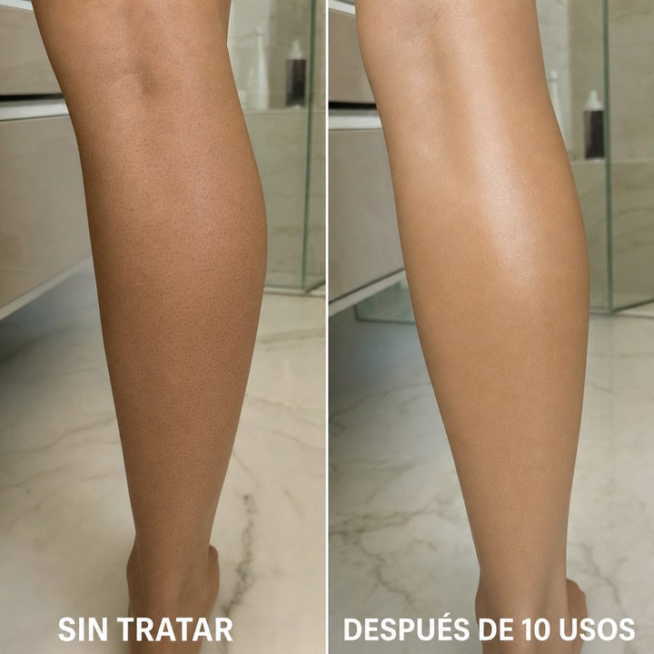 Complejo Triple Ácido — Adiós Piel de Fresa