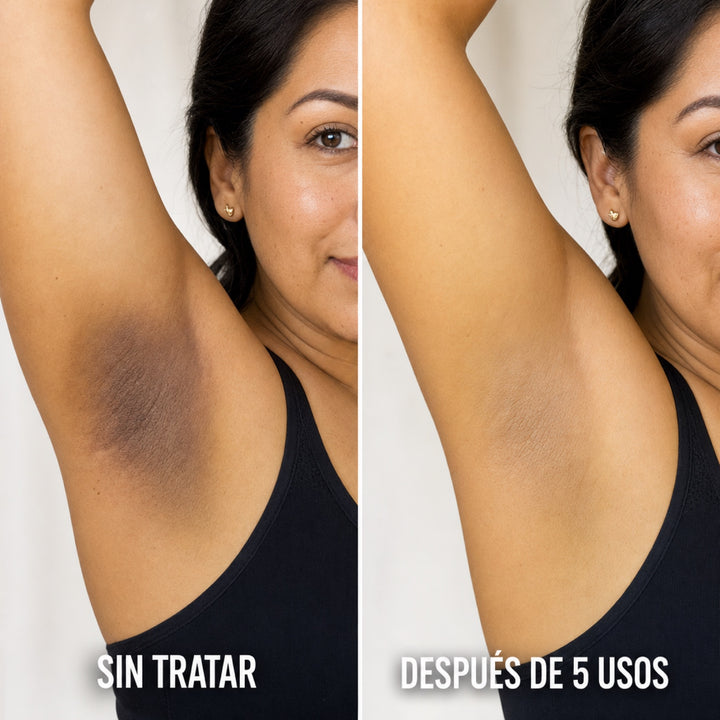 Complejo Triple Ácido — Adiós Manchas