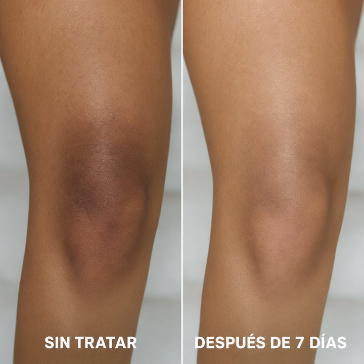 Complejo Triple Ácido — Adiós Manchas