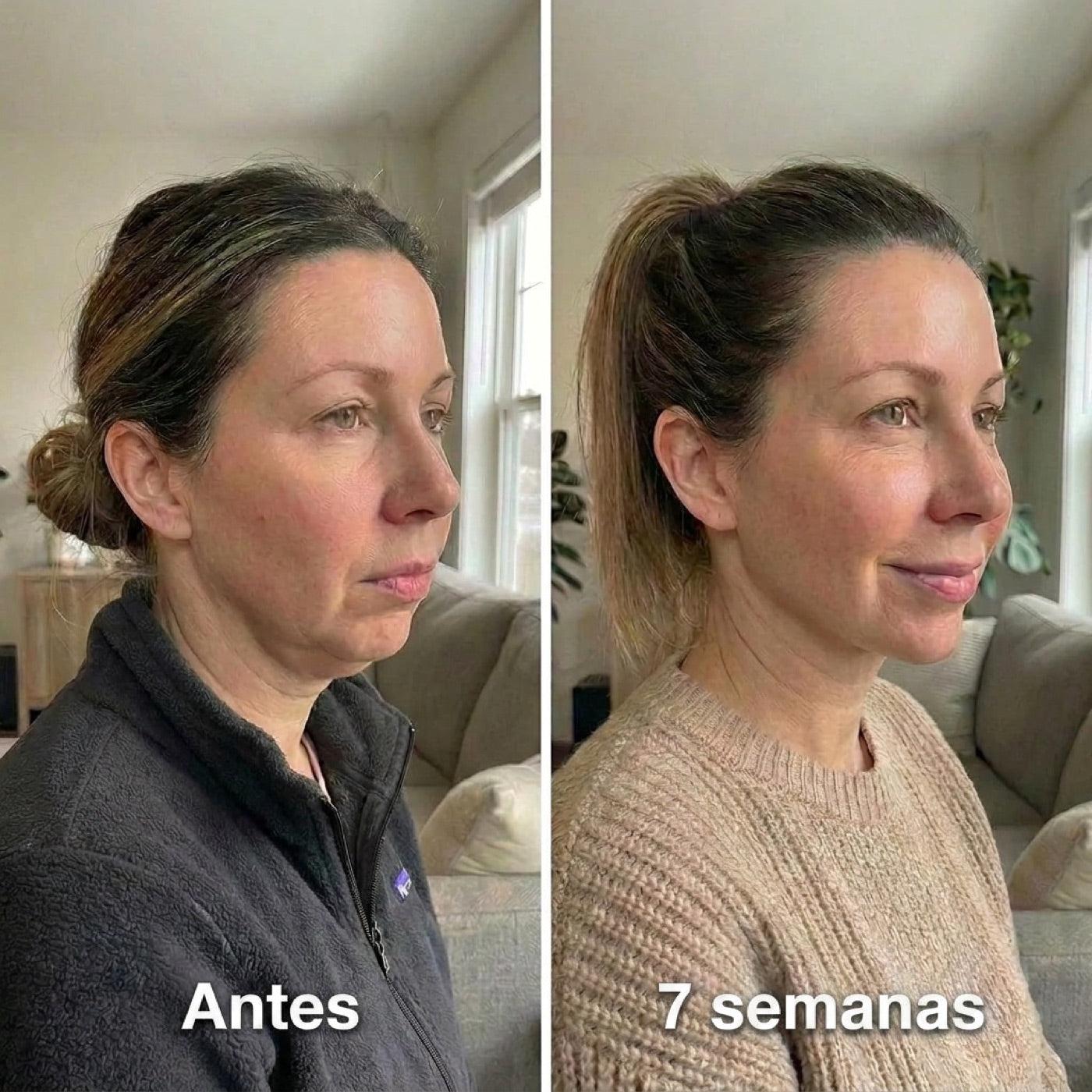 Antes y después — óvalo definido en 7 semanas
