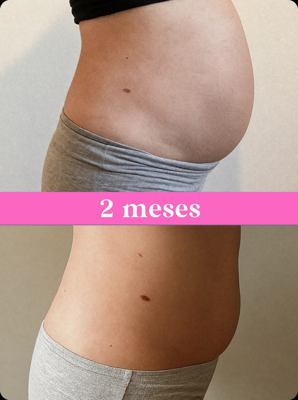 Progreso de abdomen a los 2 meses de uso