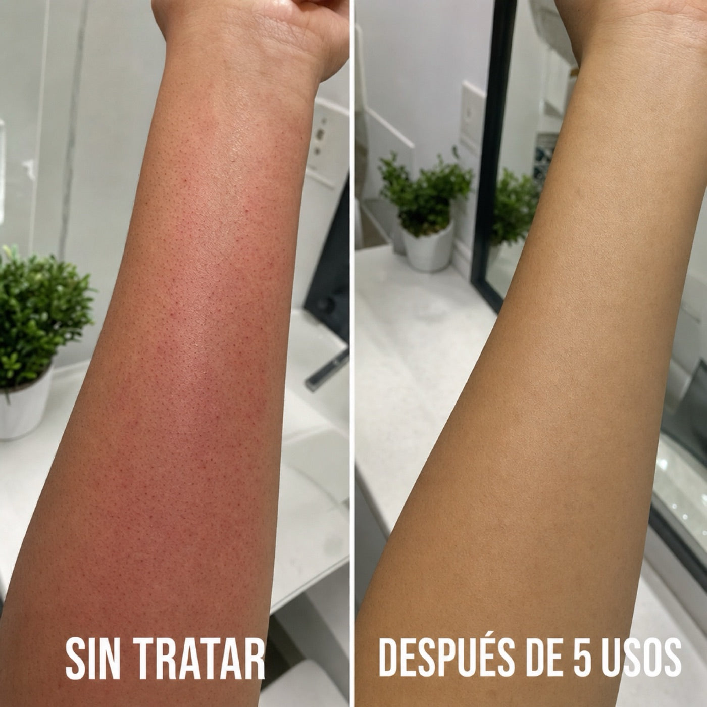 Antebrazo sin tratar vs. después de 5 usos