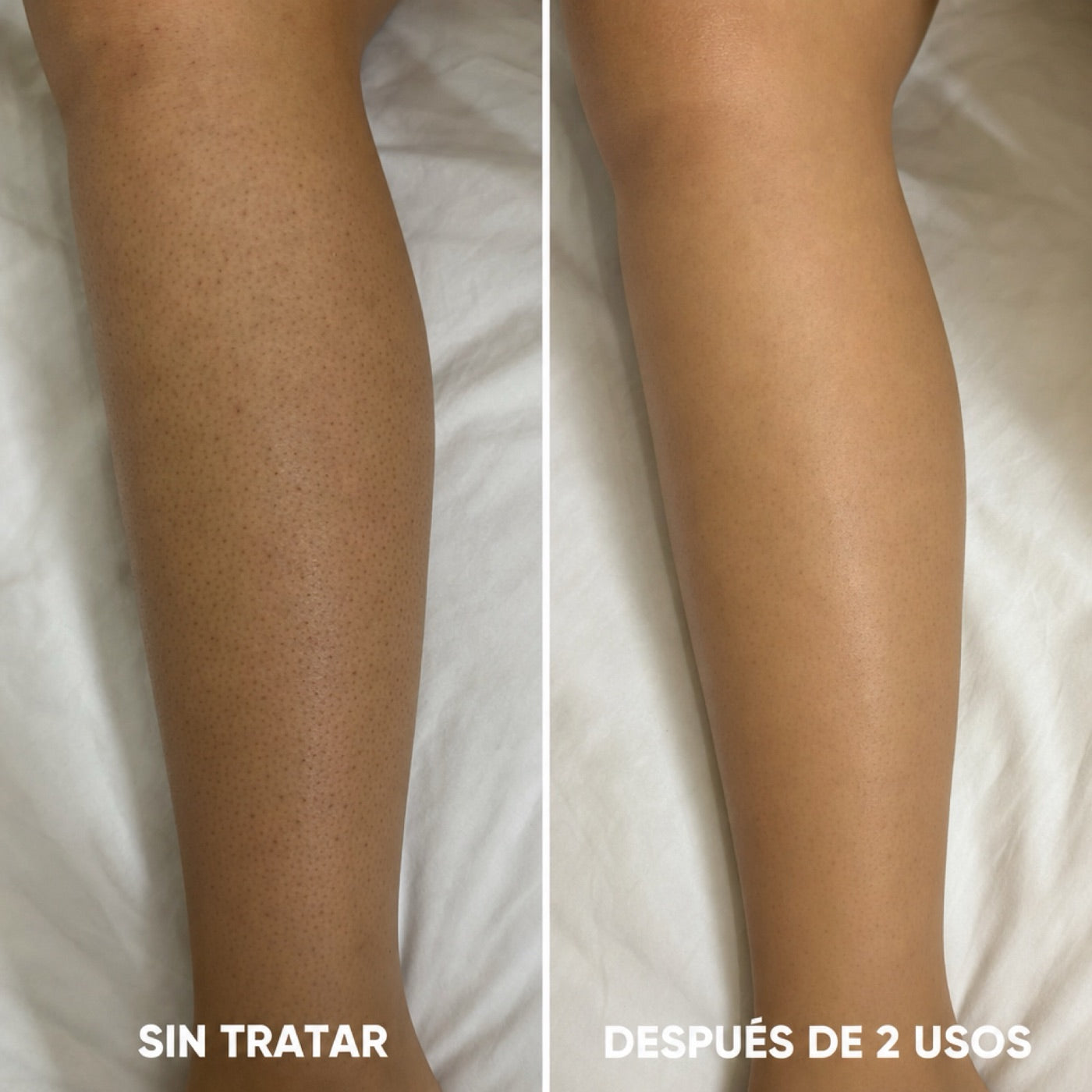 Pantorrillas sin tratar vs. después de 2 usos