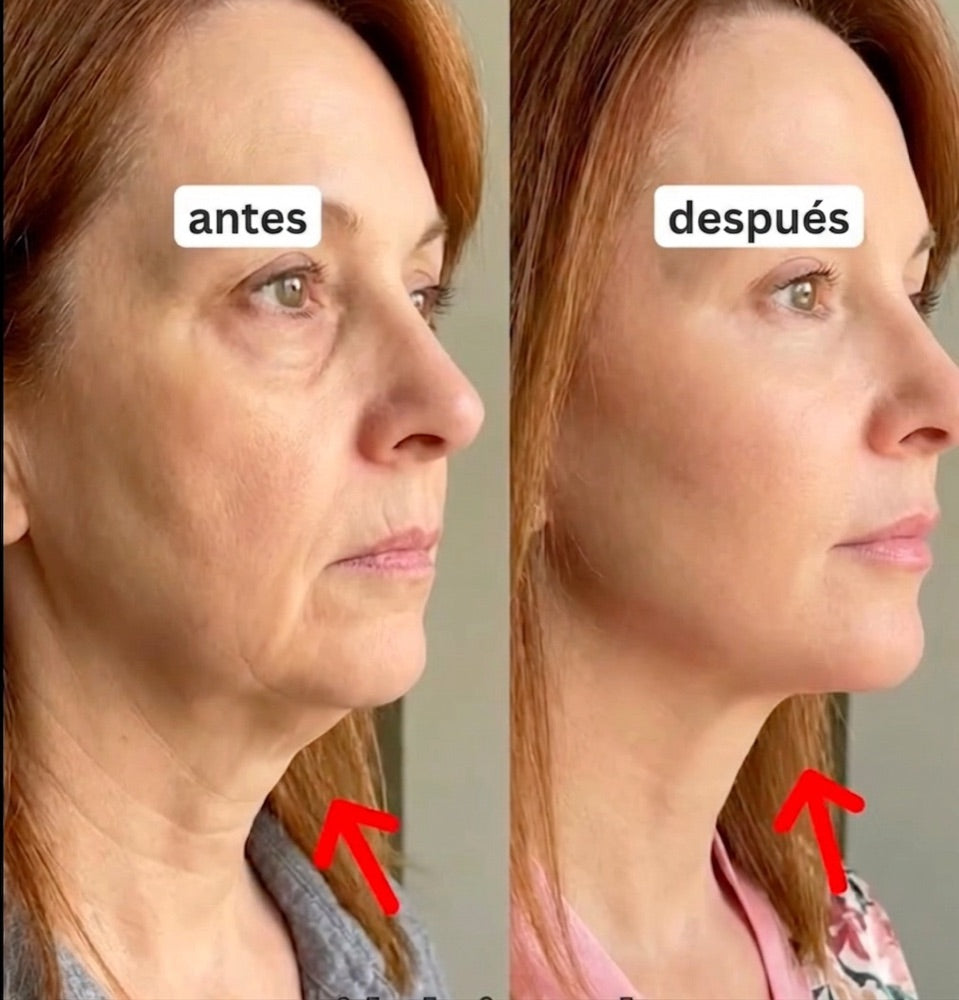 Antes y después — Norma S.