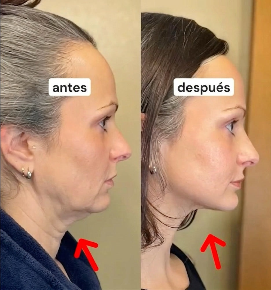 Antes y después — Leticia R.