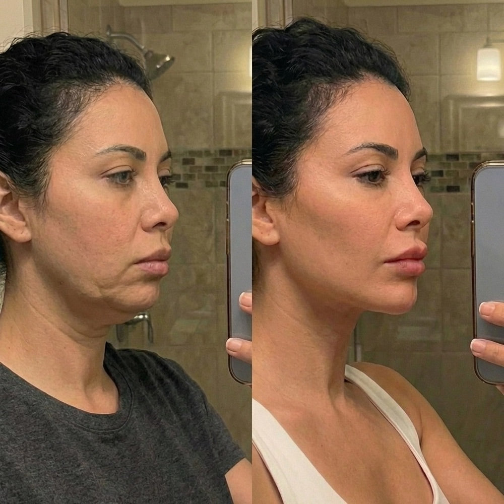 Antes y después — Paola M.