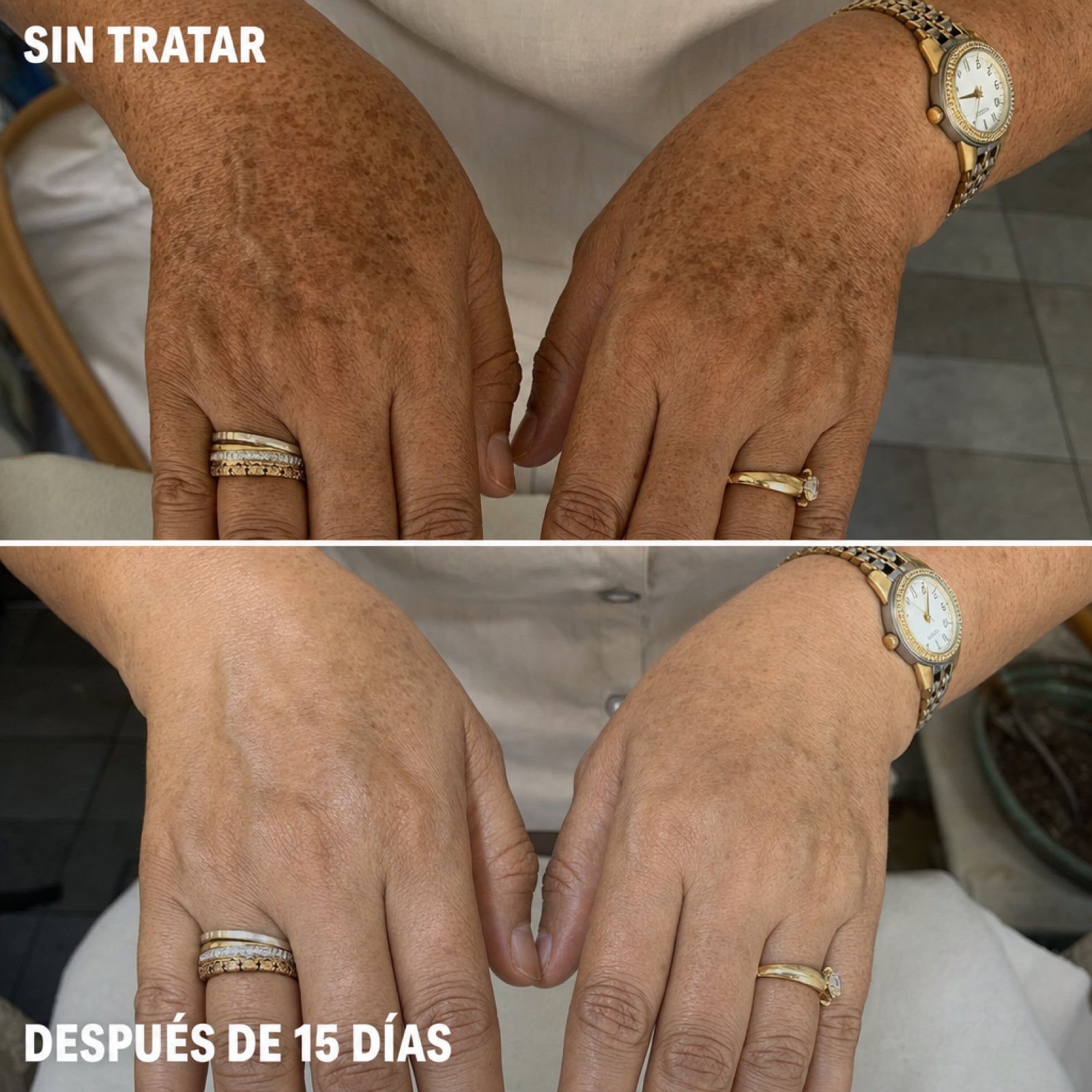 Antes y después
